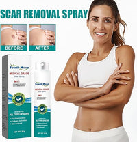 Woman using South Moon Medical Grade Scar Spray showing before and after scar removal results – advanced scar treatment for smooth, clear skin