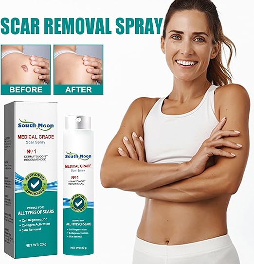 Woman using South Moon Medical Grade Scar Spray showing before and after scar removal results – advanced scar treatment for smooth, clear skin